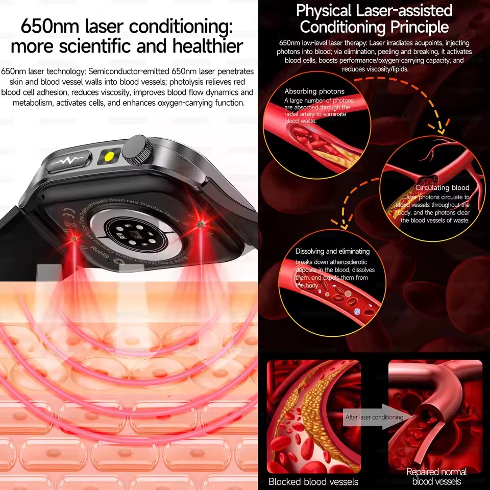 2026 New Health Smart Watch La - Industrial Laser Temperature ulasan dan harga